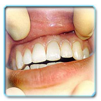 Коронковая часть зуба